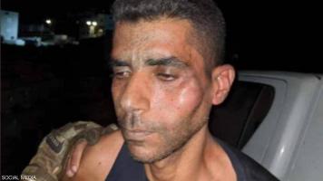 इज़रायली सुरक्षा बलों की कथित यातना के बाद पकड़े गए फ़रार क़ैदी ज़ुबैदी अस्पताल में भर्ती