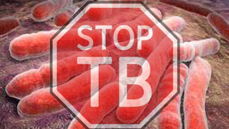 tuberculosis