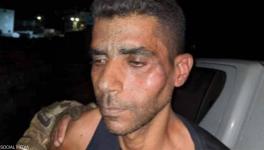 इज़रायली सुरक्षा बलों की कथित यातना के बाद पकड़े गए फ़रार क़ैदी ज़ुबैदी अस्पताल में भर्ती